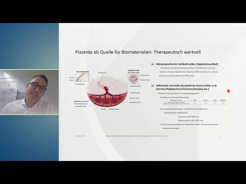 Webinar - Anwendungspotenzial und aktuelle klinische Anwendungen von Stammzellen aus der Nabelschnur und Plazenta